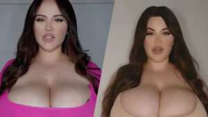 Australian Woman’s Battle with Unrelenting Breast Growth: A Personal Struggle